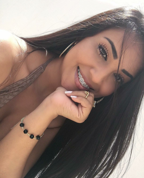 Latina with braces