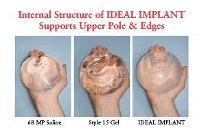 Saline vs silicone breast implants