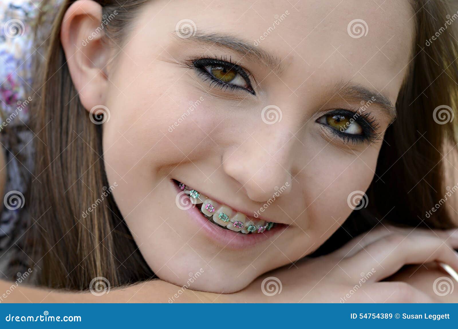 Cute teens with braces facial