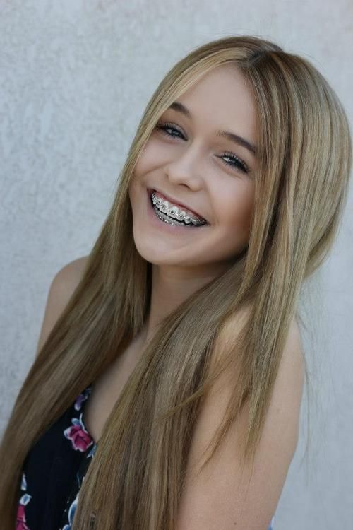 Cute teens with braces facial gif