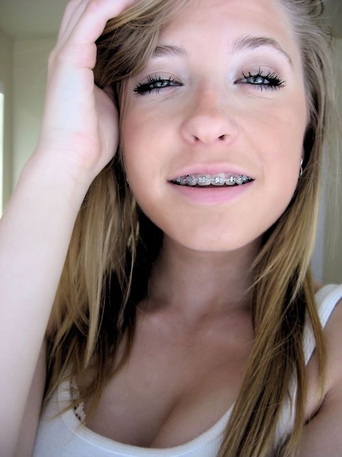 facial braces teens Cute with