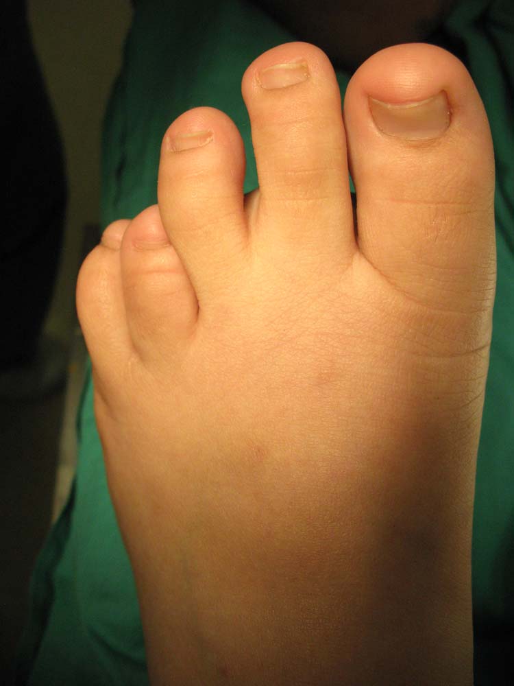 Melissa midwest toes