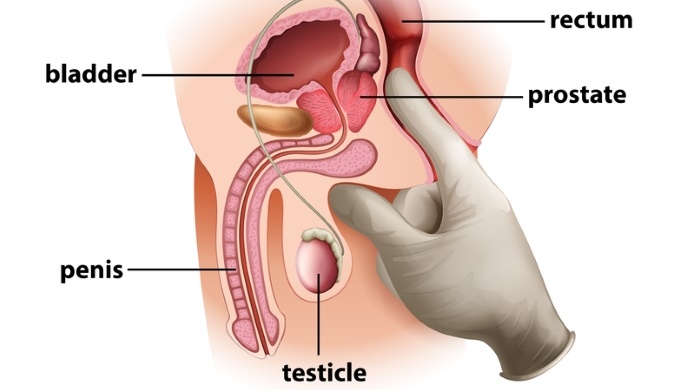 Male anal masterbation prostate