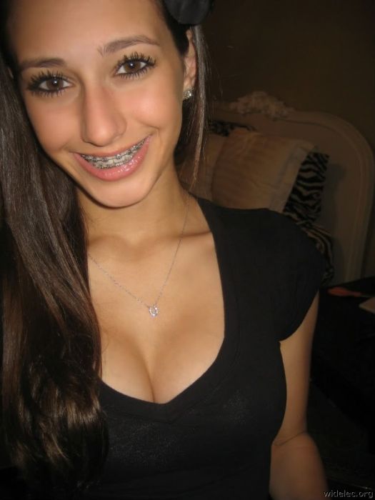 Naked twins girls with braces