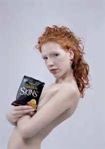 Naked albino girl